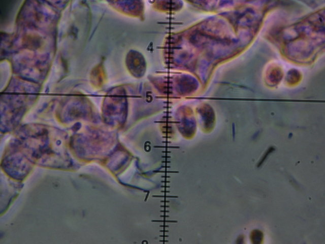 Botryobasidium con spore finemente verrucose